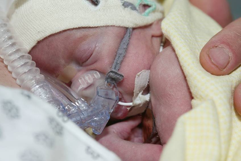 Stop checking baseline cortisol levels for preemies with hypotension