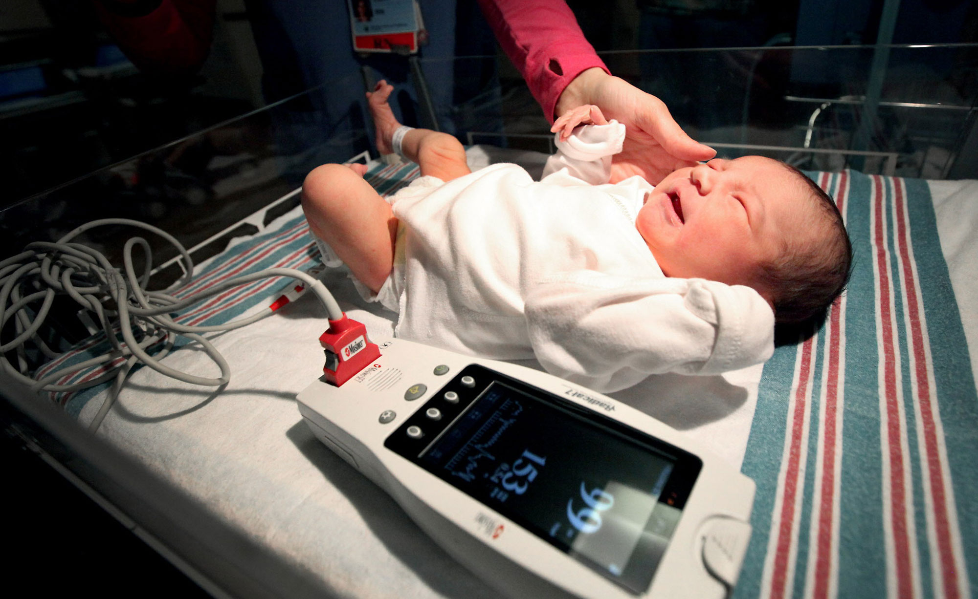 Detecting Congenital Heart Defects After Home Birth