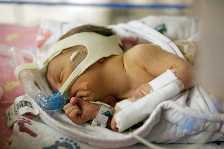 Does High Flow Really Have A Place in the NICU At All?