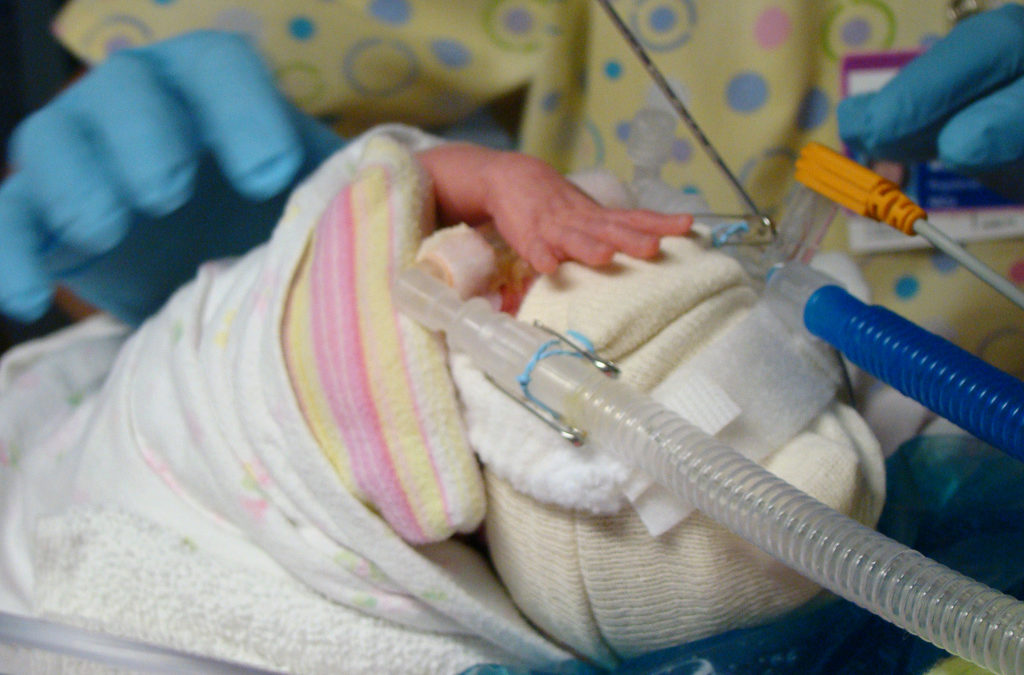 A Model For Reducing Parental Stress in the NICU.
