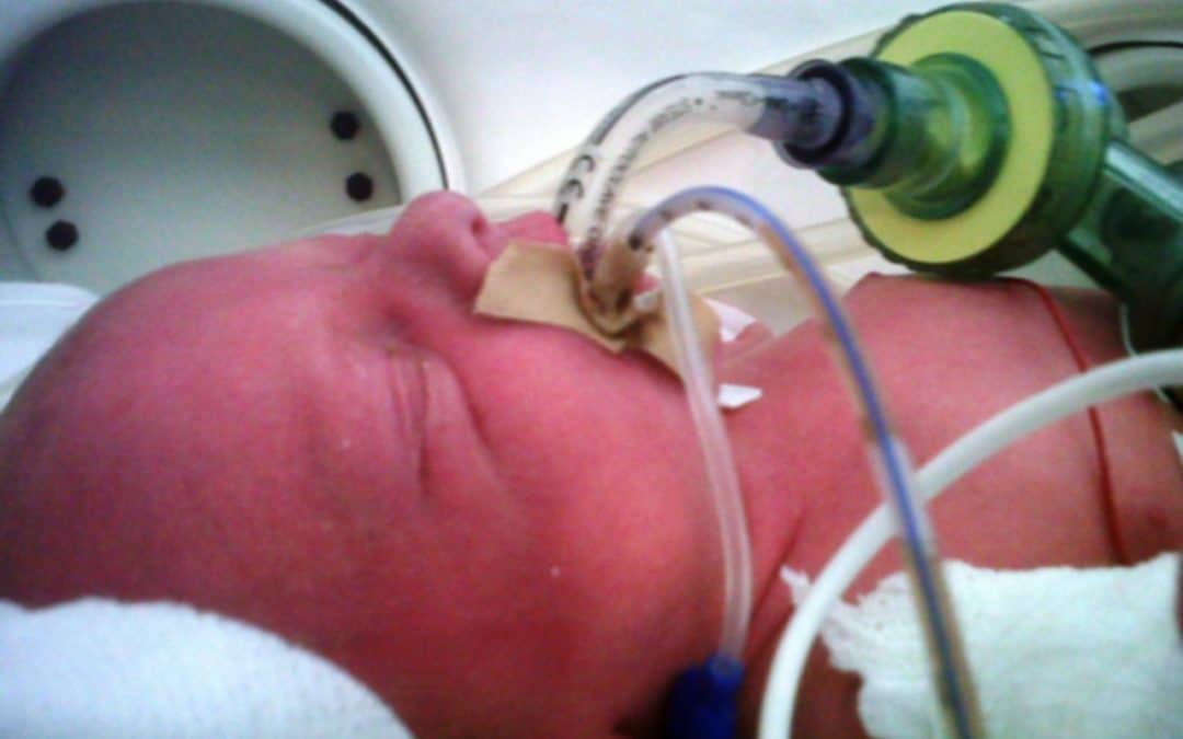 Still performing awake intubations in newborns? Maybe this will change your mind.