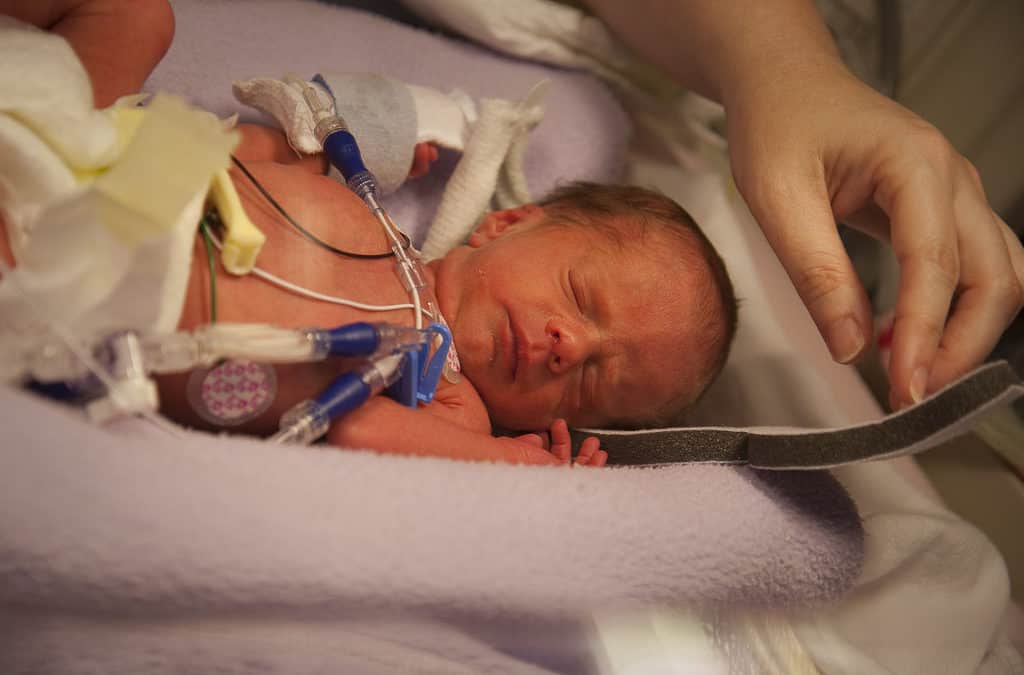 Perhaps it is time to change the way we use caffeine in the NICU.