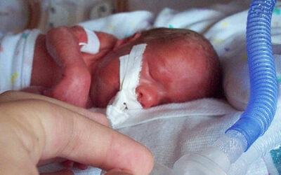 Can  a couple puffs of albuterol help preemies on mechanical ventilation?