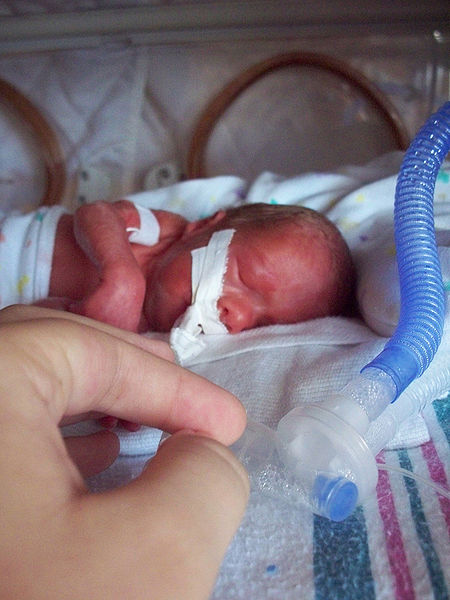 Can  a couple puffs of albuterol help preemies on mechanical ventilation?